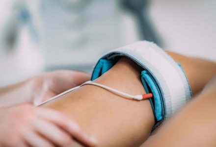TENS, Transcutaneous Electrical Nerve Stimulation in Physical Therapy. Therapist Positioning Electrodes onto Patient's Knee